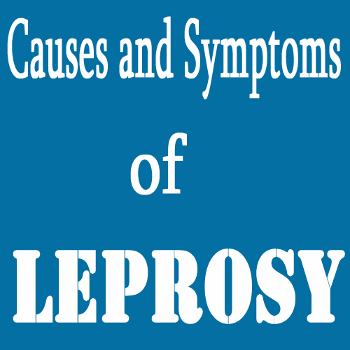 20 Common Causes and Symptoms of Leprosy